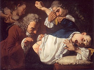 Die Operation
